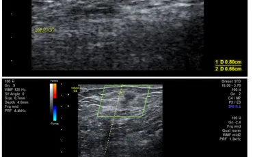 Case 1 figure 2 illustration