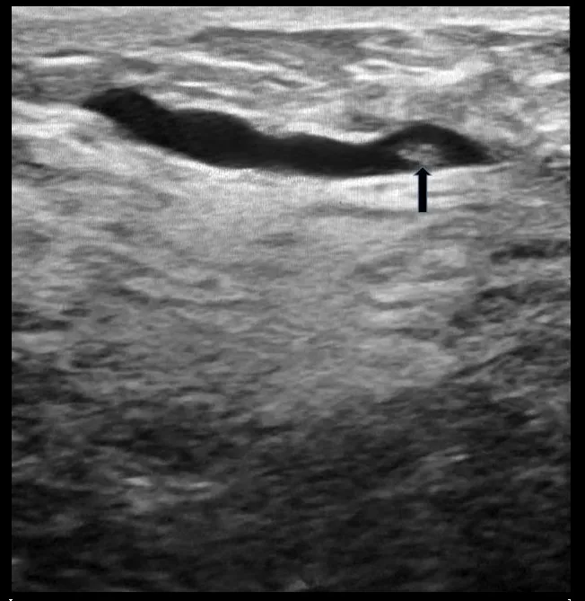 Figure 1A illustration