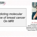 Dose #26 Molecular BC subtypes Dr. Dina Elmetwaly