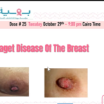 Dose #25 Paget disease Dr. Walaa Abdel Aziz