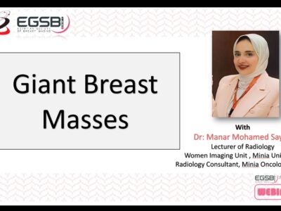 Dose #18 Giant breast masses Dr. Manar M. Sayed