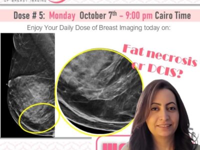 Dose # 5 Fat necrosis Dr.Merit Elmaadawy